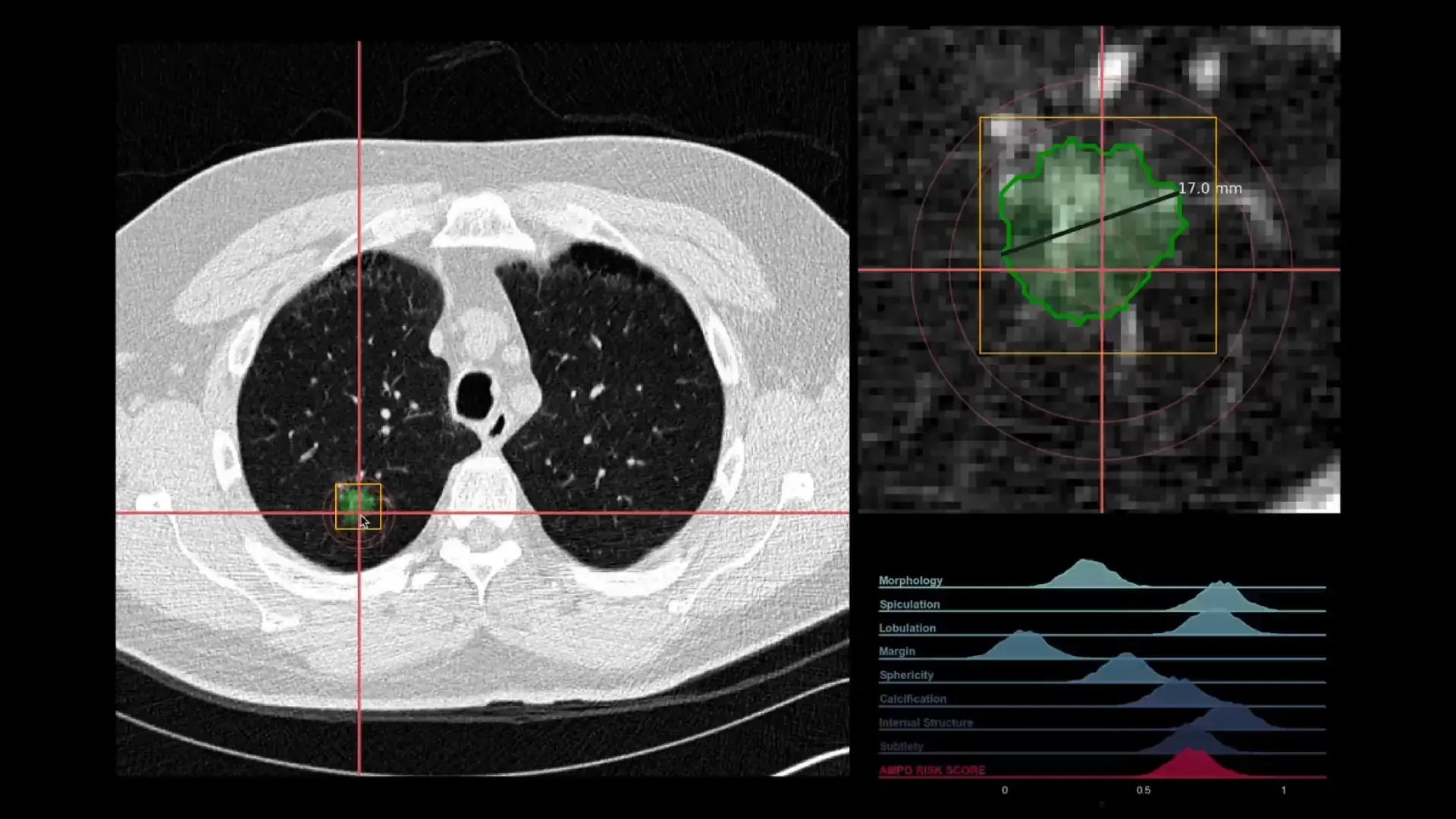 Pancreas-Thumbnail